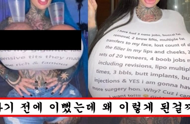 미드에 10키로짜리 실리콘 넣어버린 한국인 인스타녀 충격적인 근황
