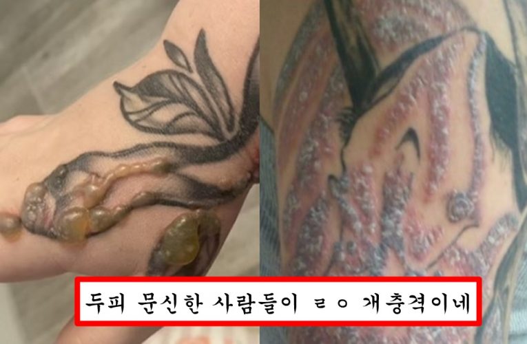 타투이스트들은 절대 말해주지 않는다는 타투 하는 사람들 많이 겪는다는 부작용